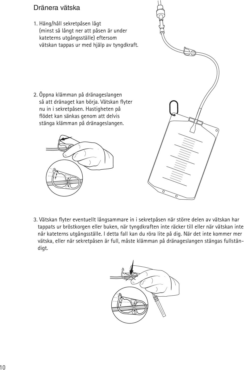 Vätskan flyter evtuellt långsammare in i sekretpås när större l av vätskan har tappats ur bröstkorg eller buk, när tyngdkraft inte räcker till eller när vätskan inte