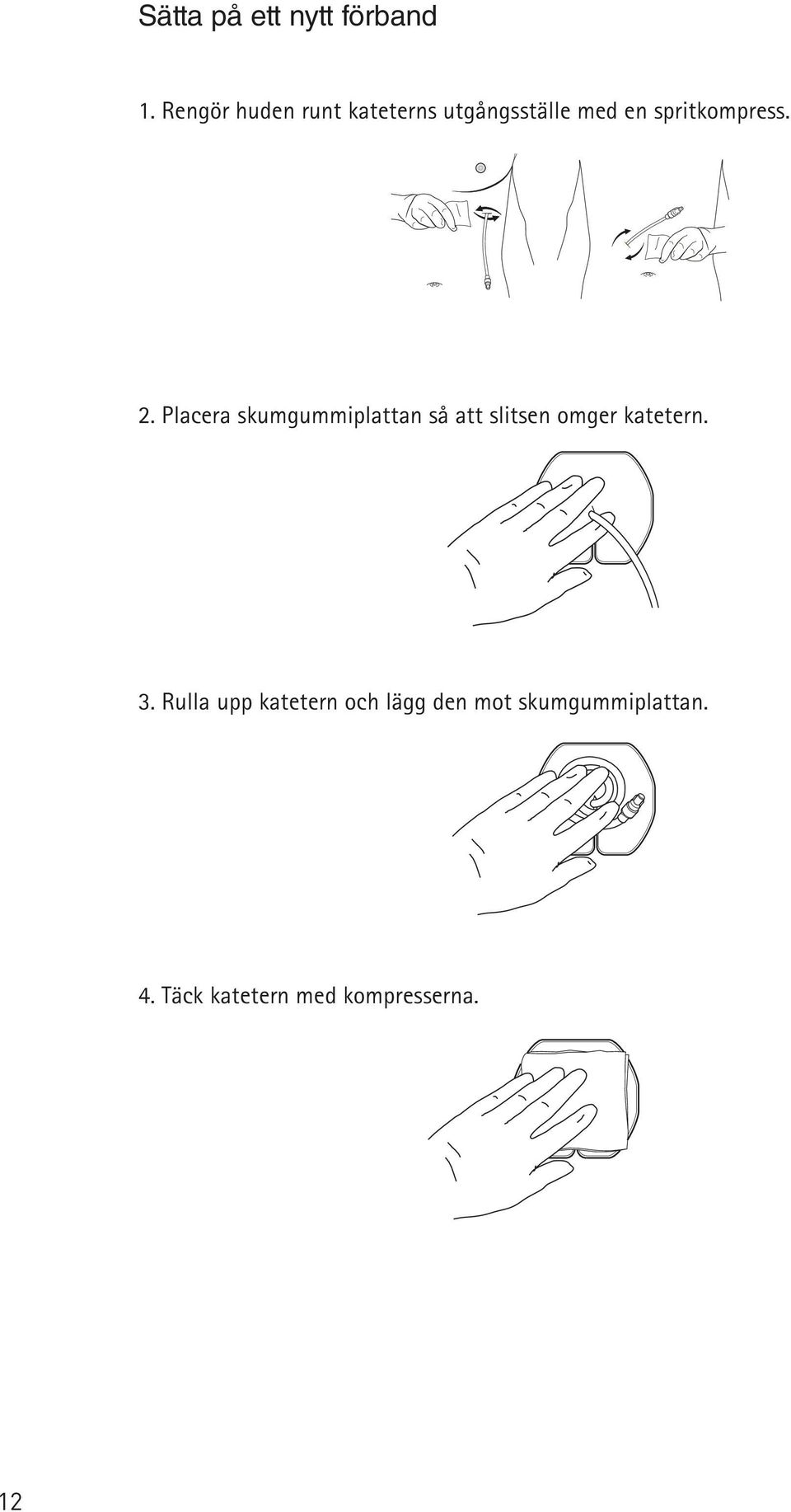 Placera skumgummiplattan så att slits omger katetern. 3.