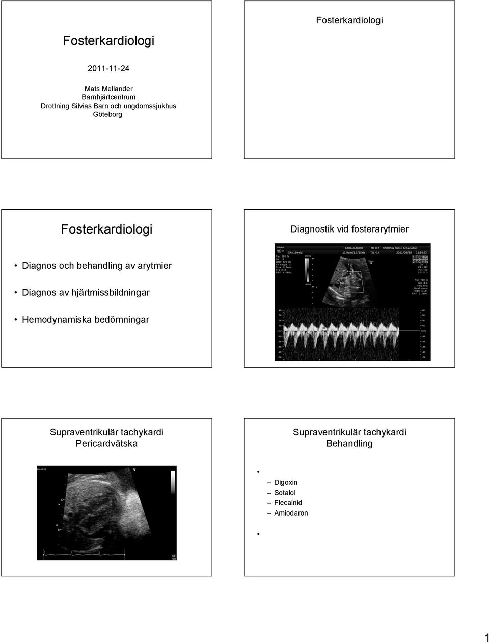 Diagnos av hjärtmissbildningar Hemodynamiska bedömningar Supraventrikulär tachykardi Pericardvätska