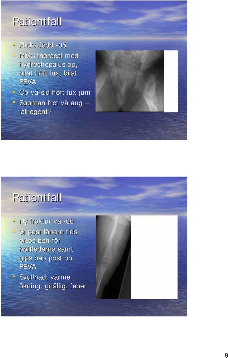 iatrogent?