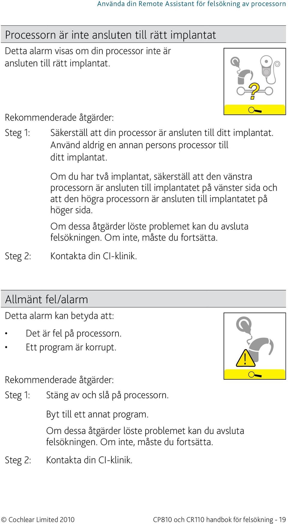 Om du har två implantat, säkerställ att den vänstra processorn är ansluten till implantatet på vänster sida och att den högra processorn är ansluten till implantatet på höger sida.