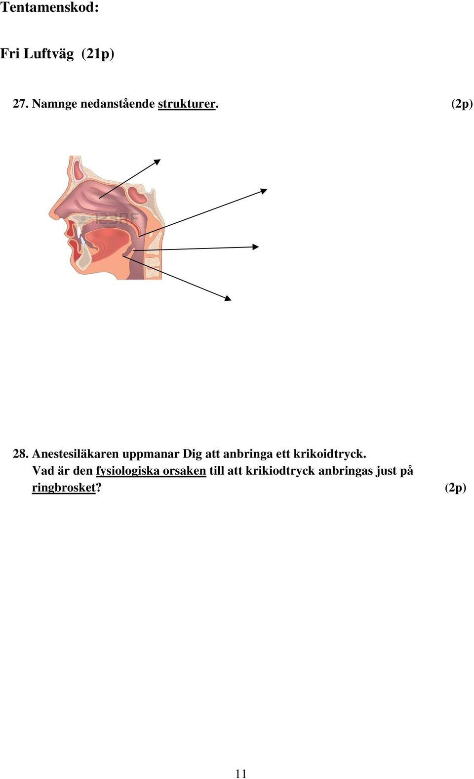 Anestesiläkaren uppmanar Dig att anbringa ett