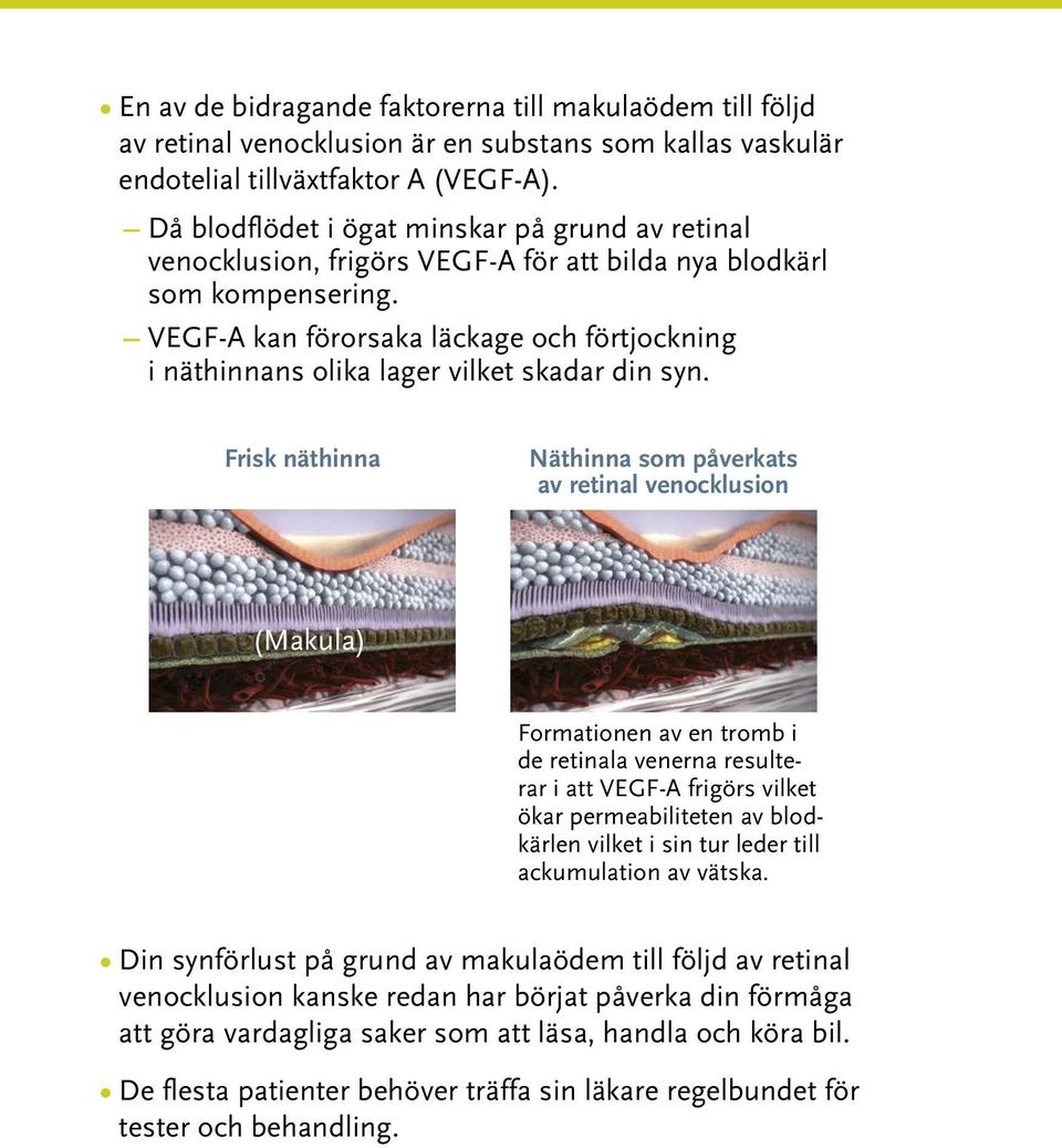 VEGF-A kan förorsaka läckage och förtjockning i näthinnans olika lager vilket skadar din syn.