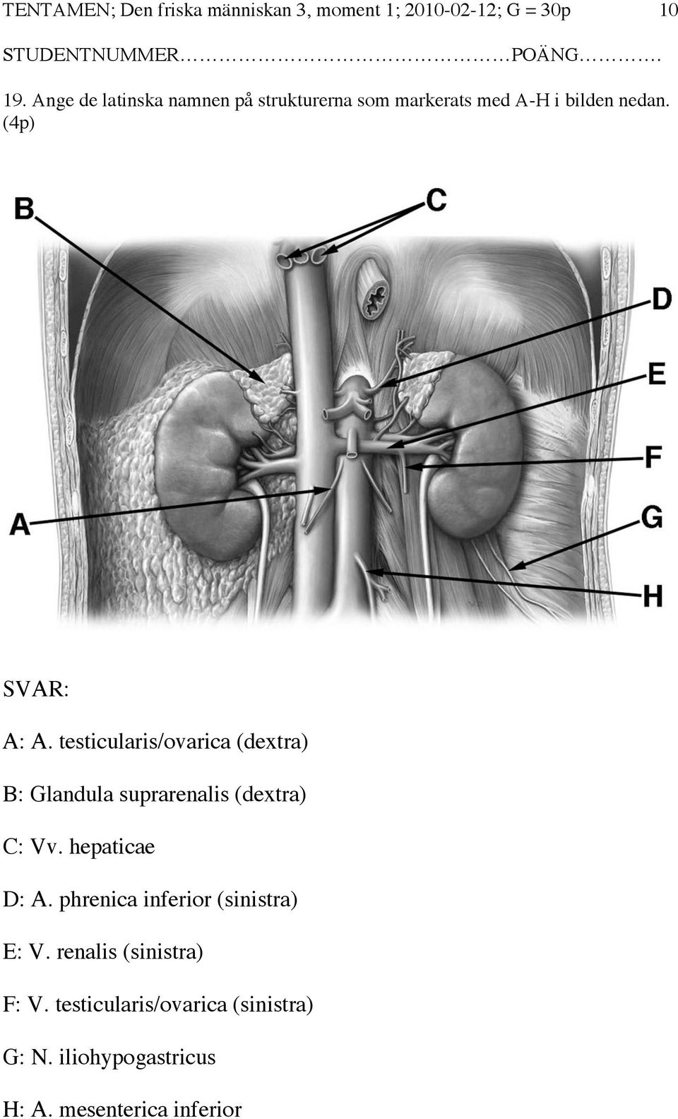 testicularis/ovarica (dextra) B: Glandula suprarenalis (dextra) C: Vv. hepaticae D: A.