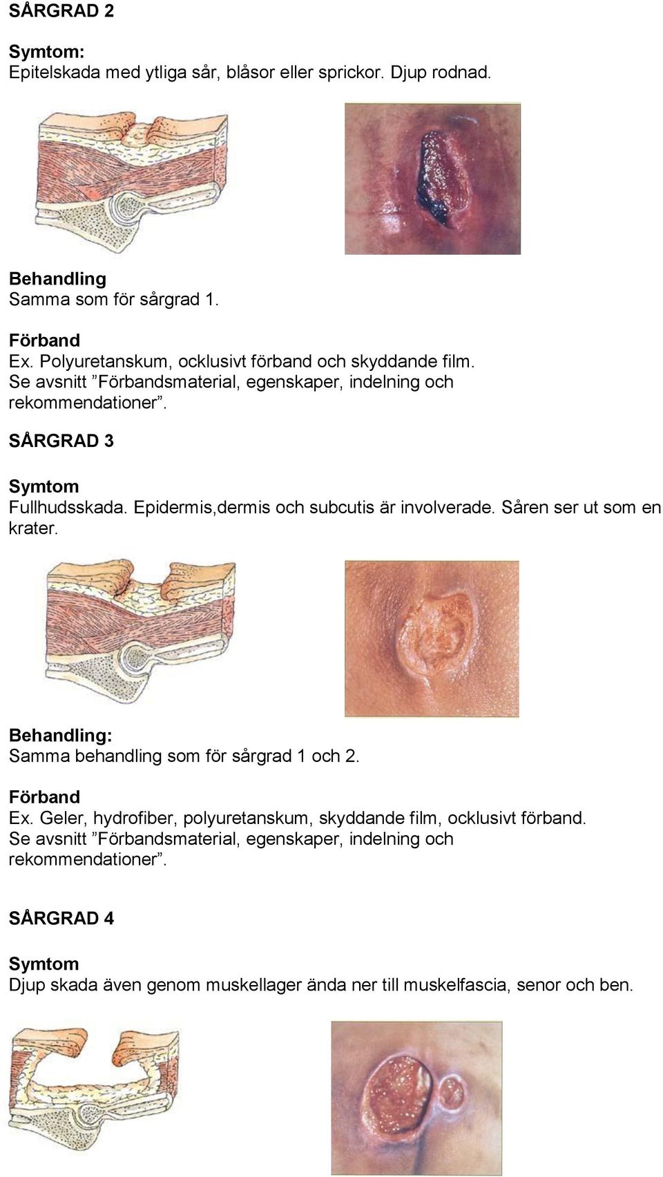 Epidermis,dermis och subcutis är involverade. Såren ser ut som en krater. Behandling: Samma behandling som för sårgrad och. Förband Ex.