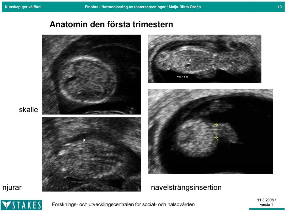 Maija-Riitta Ordén 19 Anatomin den