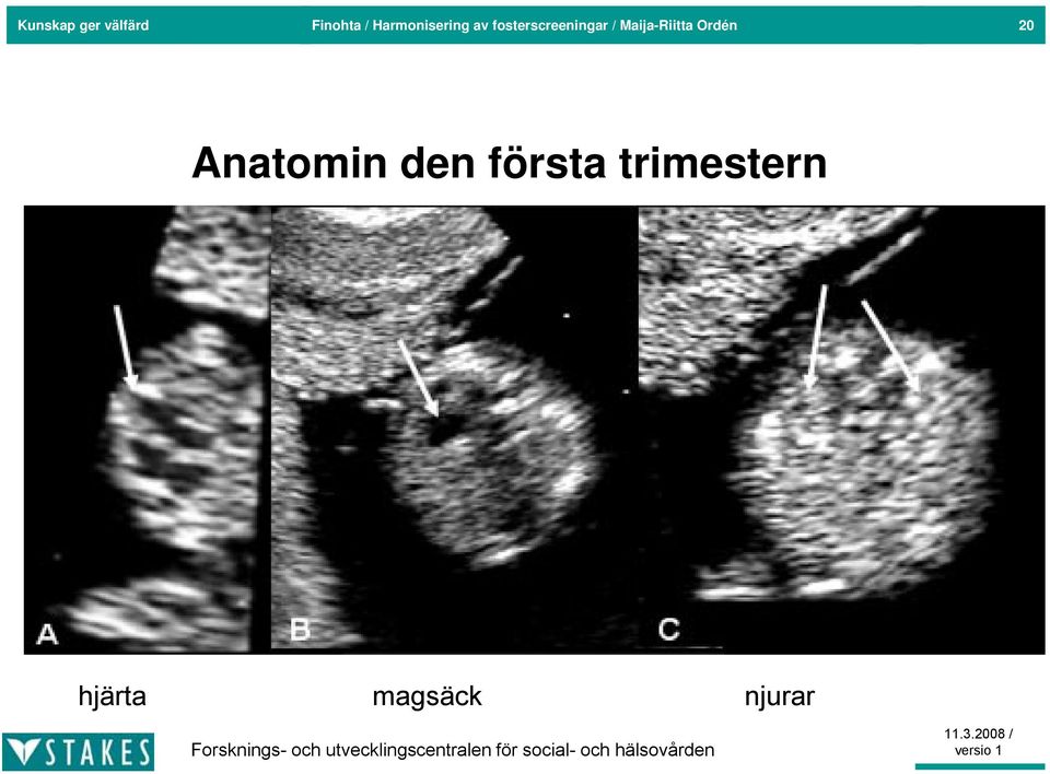 / Maija-Riitta Ordén 20 Anatomin