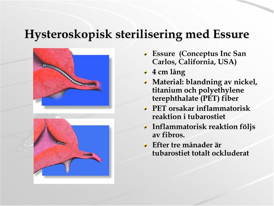polyethylene terephthalate (PET) fiber PET orsakar inflammatorisk reaktion i