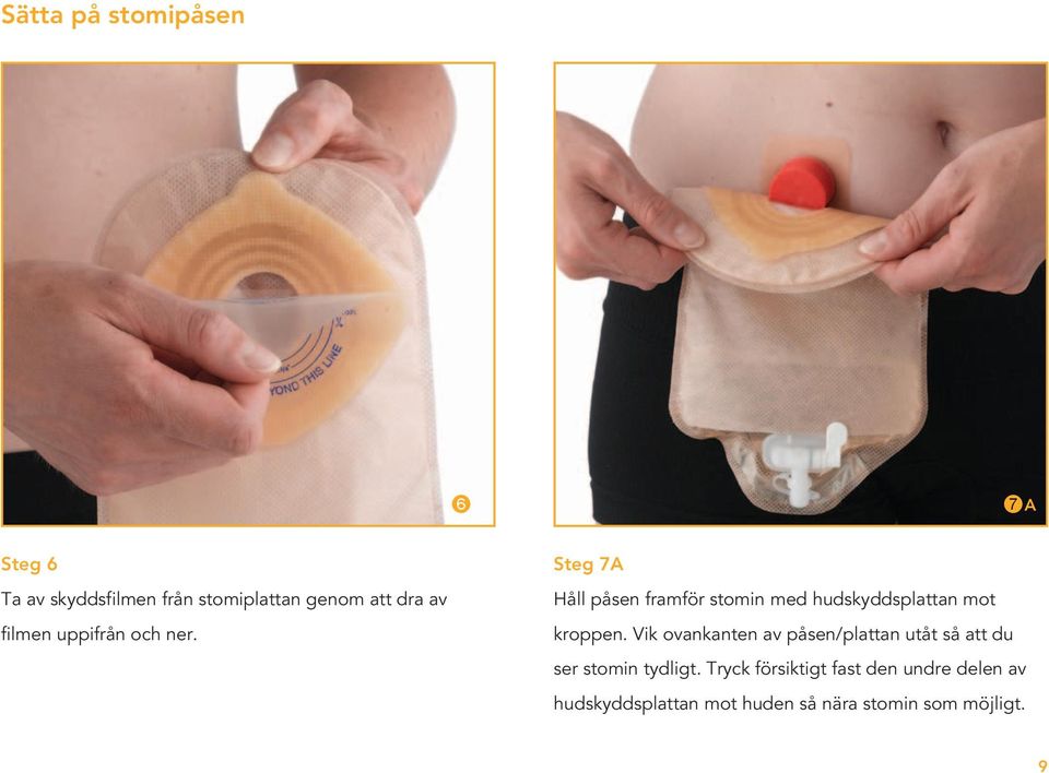Steg 7A Håll påsen framför stomin med hudskyddsplattan mot kroppen.