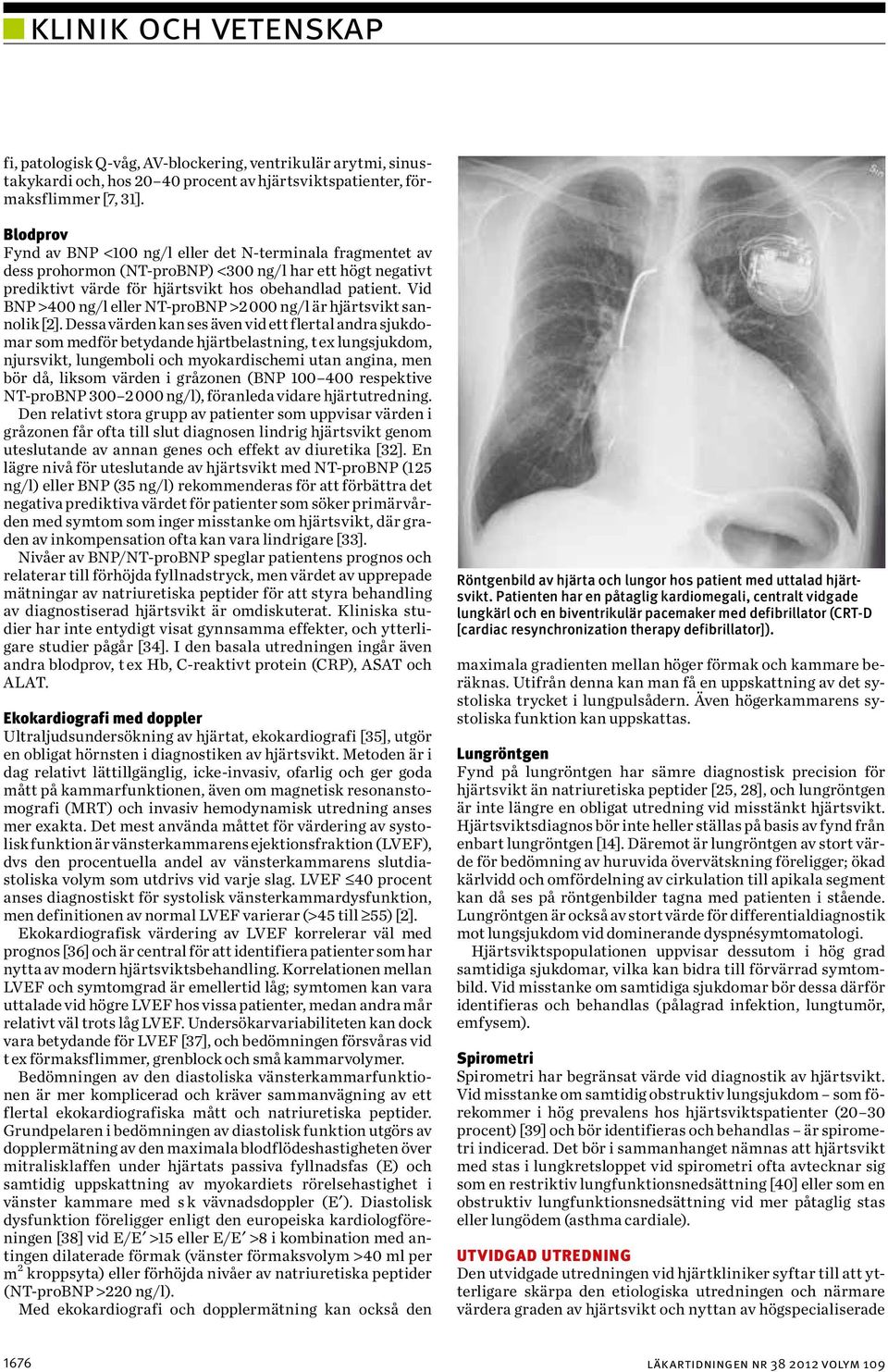 Vid BNP >400 ng/l eller NT-proBNP >2 000 ng/l är hjärtsvikt sannolik [2].