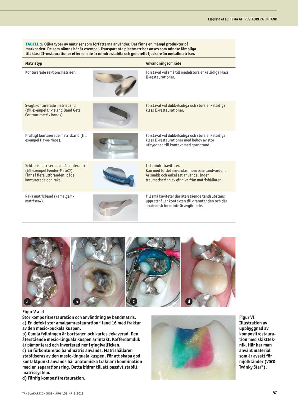 Användningsområde Förstaval vid små till medelstora enkelsidiga klass II-restaurationer. Svagt konturerade matrisband (till exempel Dixieland Band Getz Contour matrix bands).