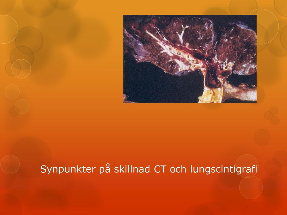 CT och