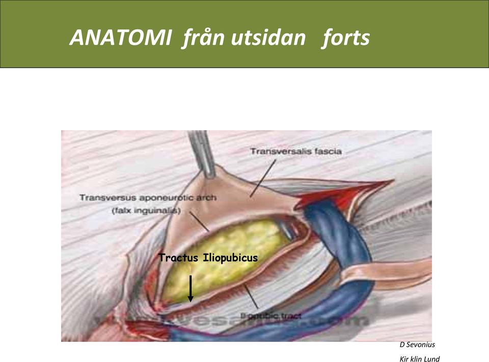 utsidan