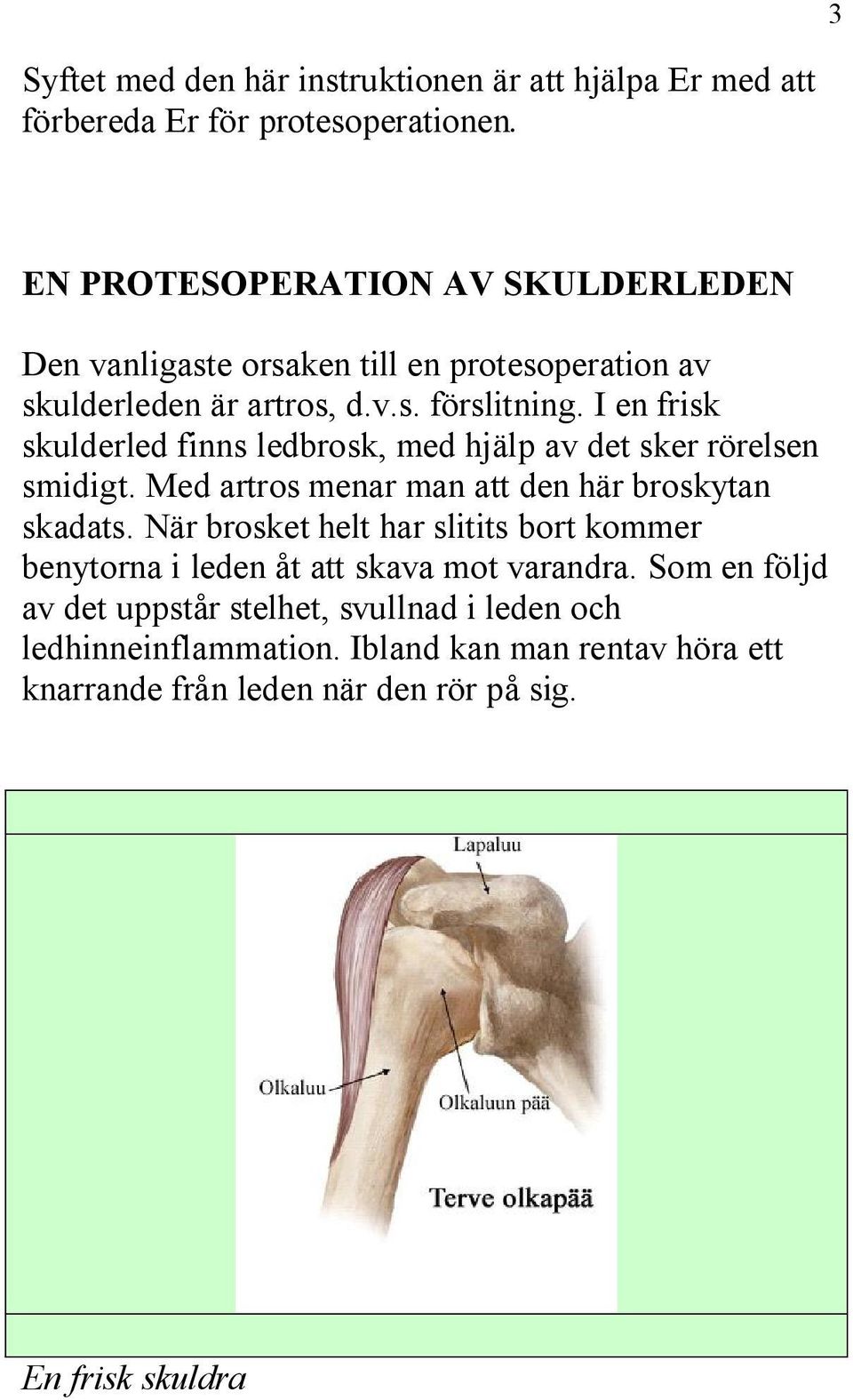 I en frisk skulderled finns ledbrosk, med hjälp av det sker rörelsen smidigt. Med artros menar man att den här broskytan skadats.