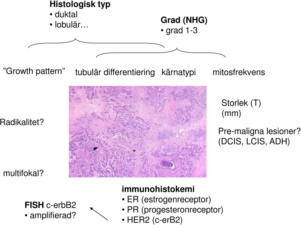 Storlek (T) (mm) Pre-maligna lesioner? (DCIS, LCIS, ADH) multifokal?