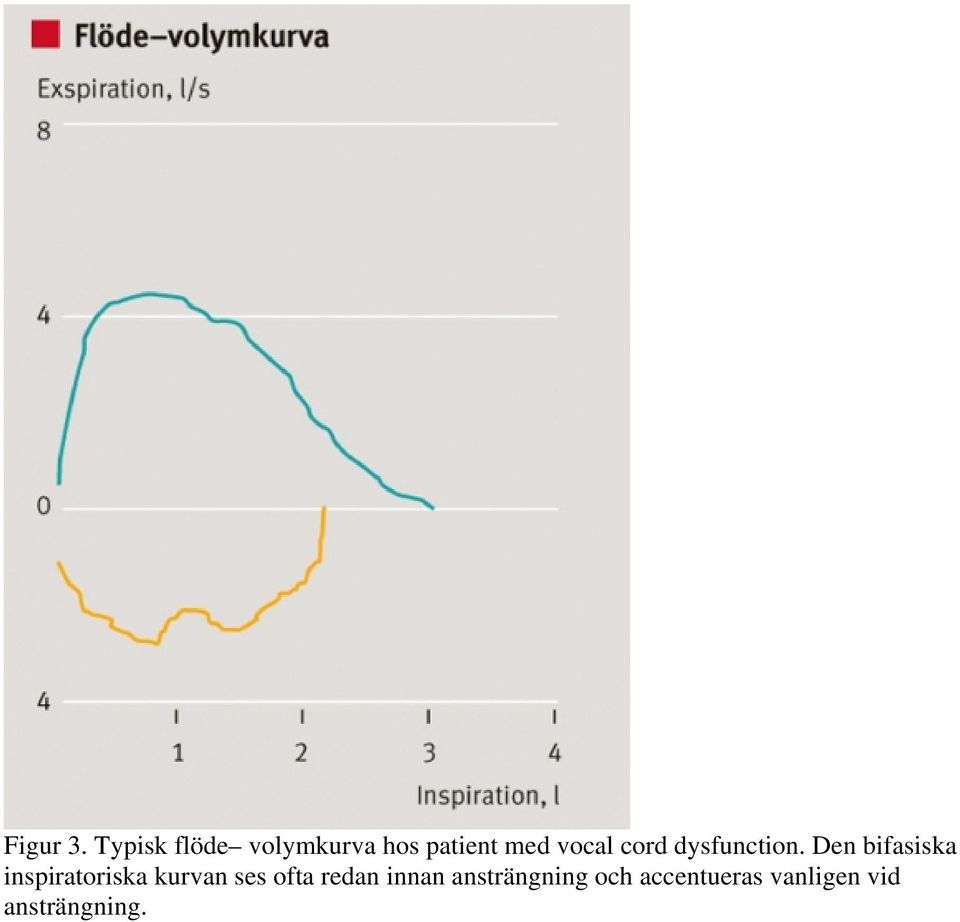 cord dysfunction.