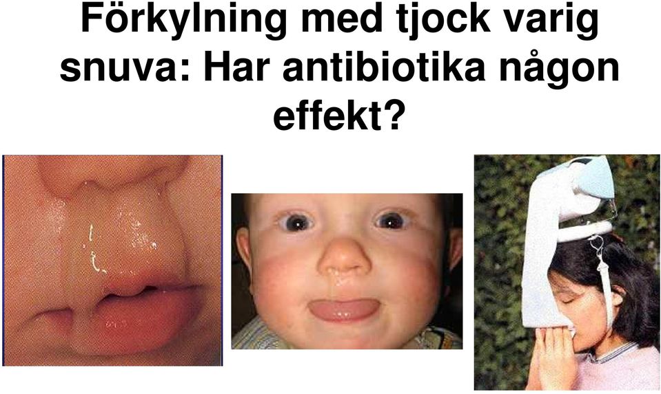 snuva: Har