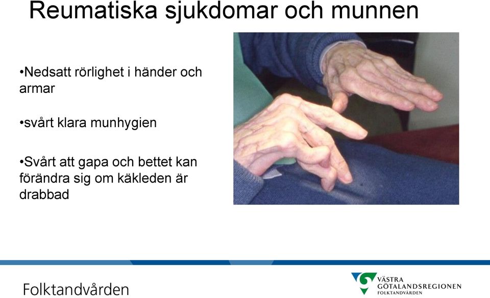 svårt klara munhygien Svårt att gapa