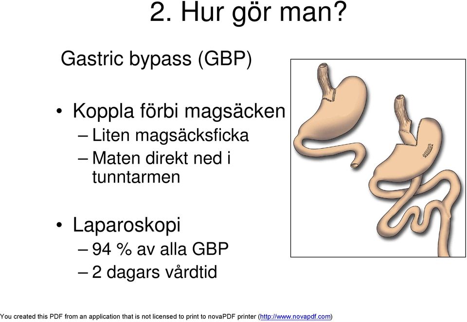 magsäcken Liten magsäcksficka Maten