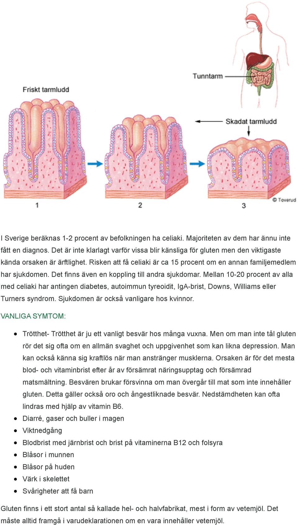 Det finns även en koppling till andra sjukdomar. Mellan 10-20 procent av alla med celiaki har antingen diabetes, autoimmun tyreoidit, IgA-brist, Downs, Williams eller Turners syndrom.