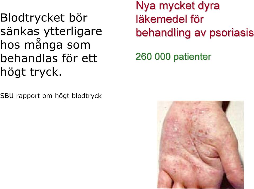 Nya mycket dyra läkemedel för behandling av