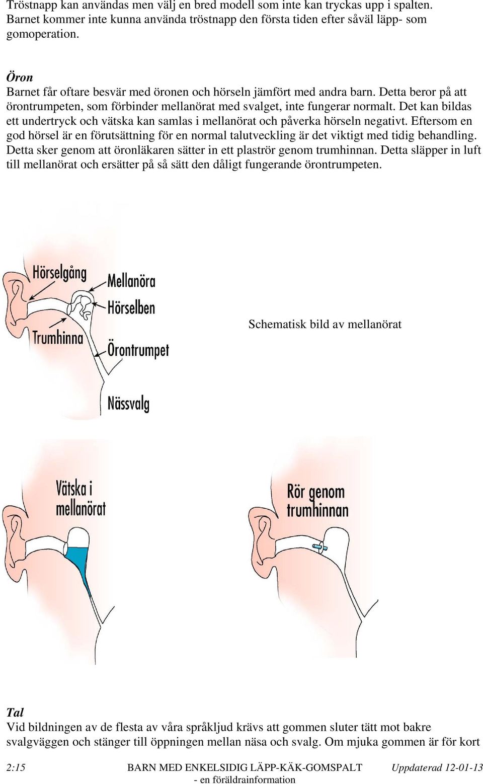 Det kan bildas ett undertryck och vätska kan samlas i mellanörat och påverka hörseln negativt.