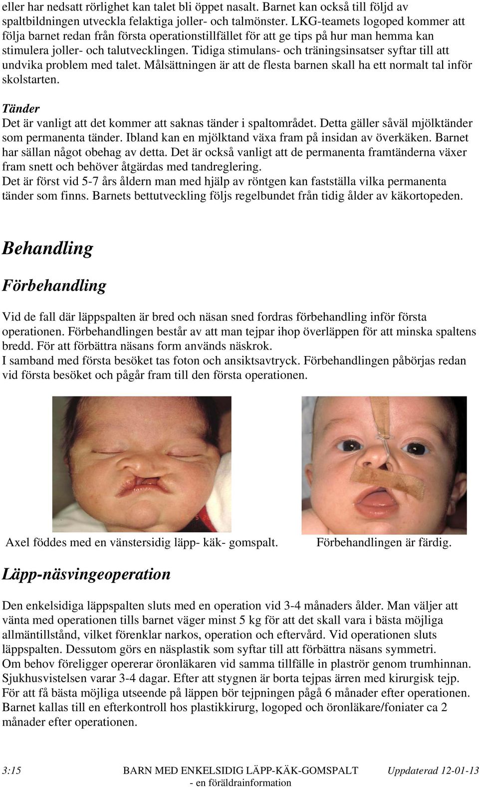 Tidiga stimulans- och träningsinsatser syftar till att undvika problem med talet. Målsättningen är att de flesta barnen skall ha ett normalt tal inför skolstarten.