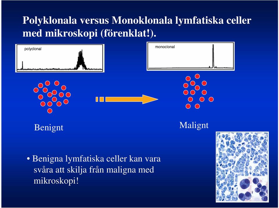 Benignt Malignt Benigna lymfatiska celler