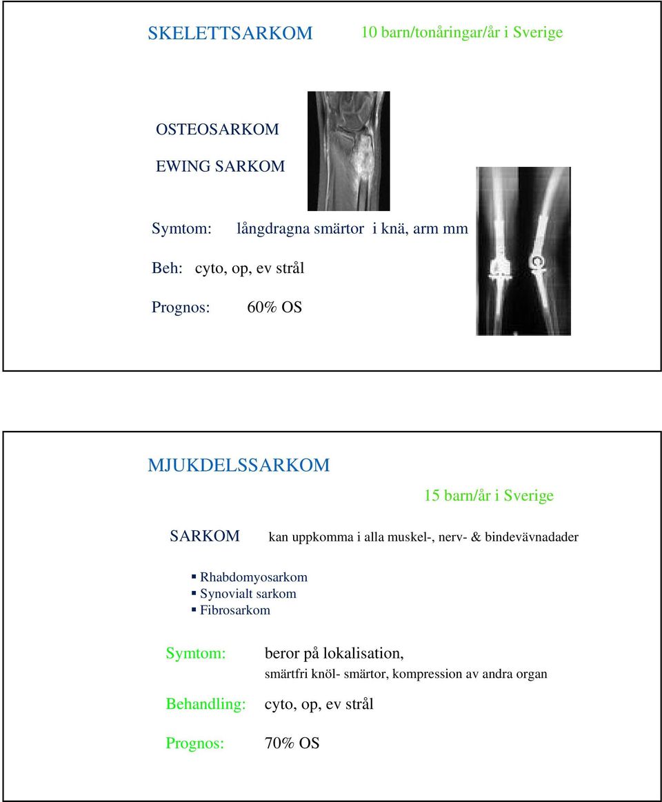 alla muskel-, nerv- & bindevävnadader Rhabdomyosarkom Synovialt sarkom Fibrosarkom Symtom: Behandling: