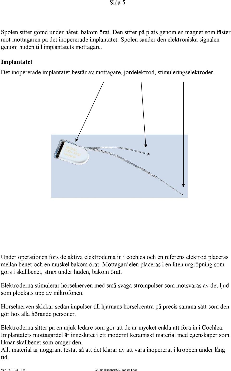 Under operationen förs de aktiva elektroderna in i cochlea och en referens elektrod placeras mellan benet och en muskel bakom örat.