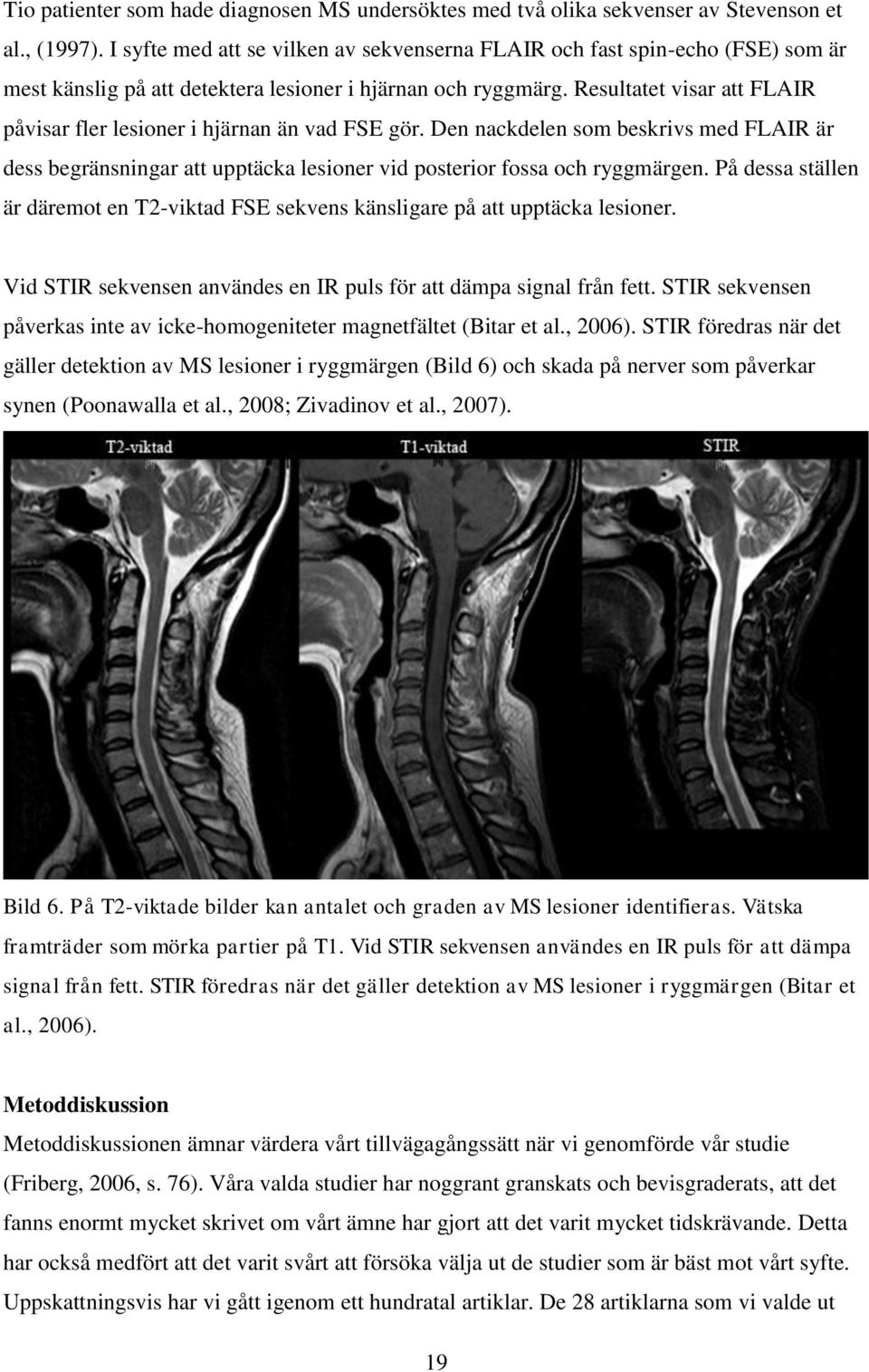 Resultatet visar att FLAIR påvisar fler lesioner i hjärnan än vad FSE gör. Den nackdelen som beskrivs med FLAIR är dess begränsningar att upptäcka lesioner vid posterior fossa och ryggmärgen.