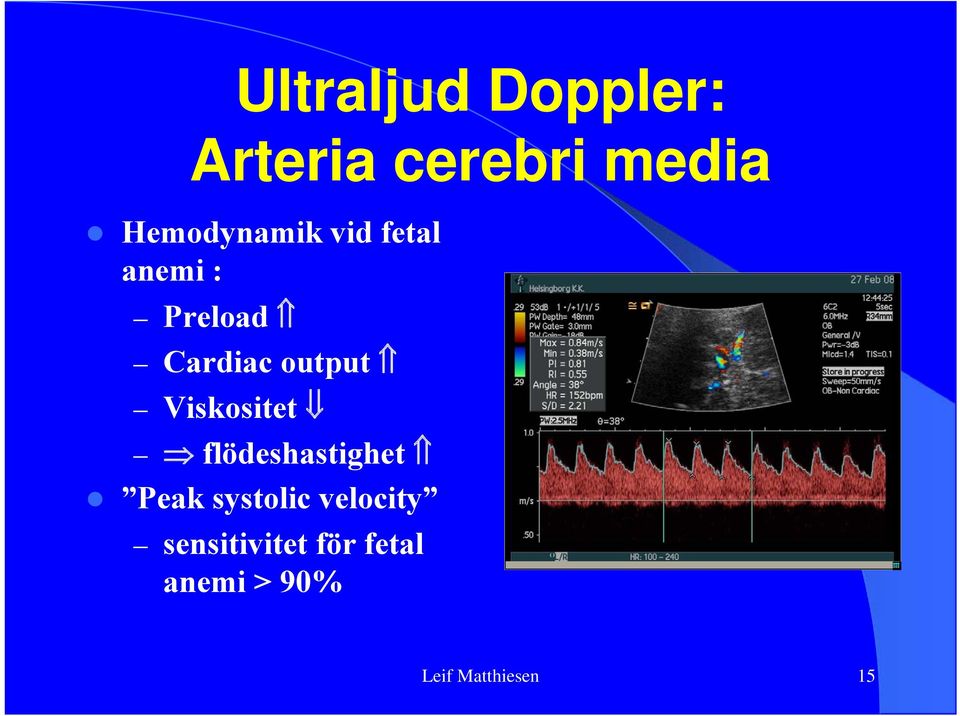 output Viskositet flödeshastighet Peak systolic