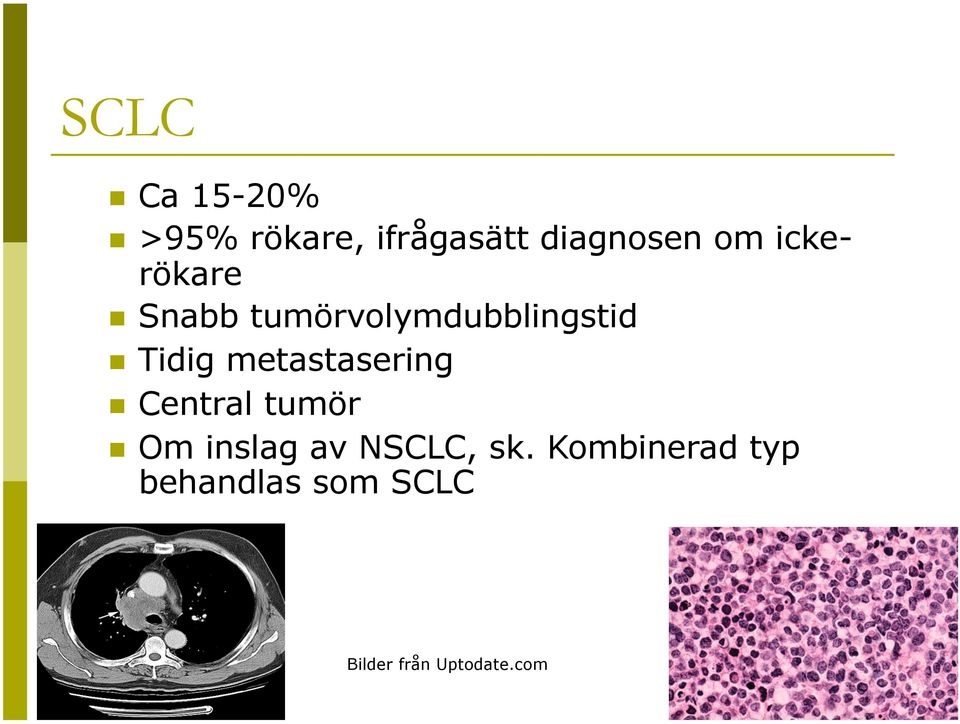 metastasering Central tumör Om inslag av NSCLC, sk.