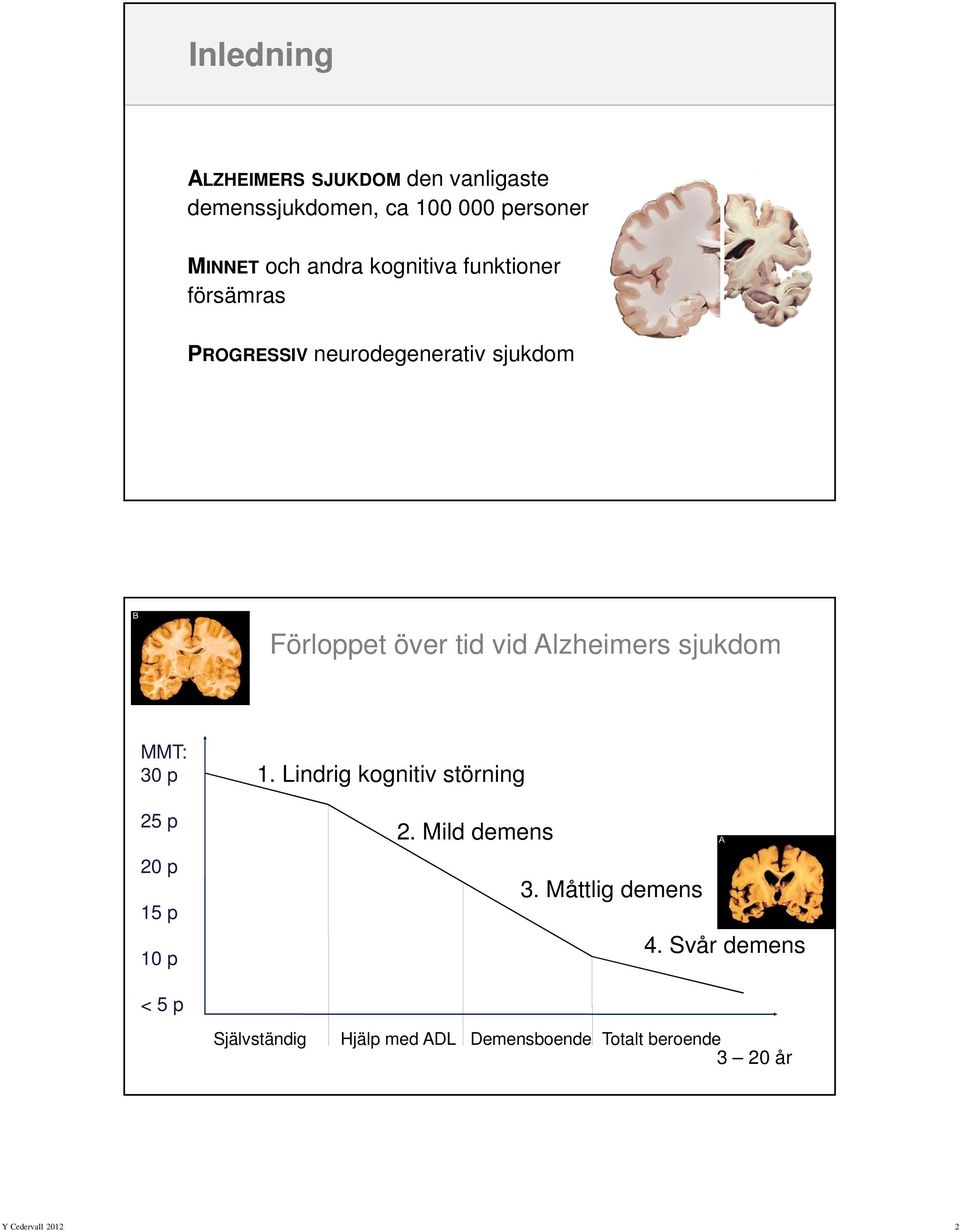 tid vid Alzheimers sjukdom MMT: 30 p 25 p 20 p 15 p 10 p 1. Lindrig kognitiv störning 2.