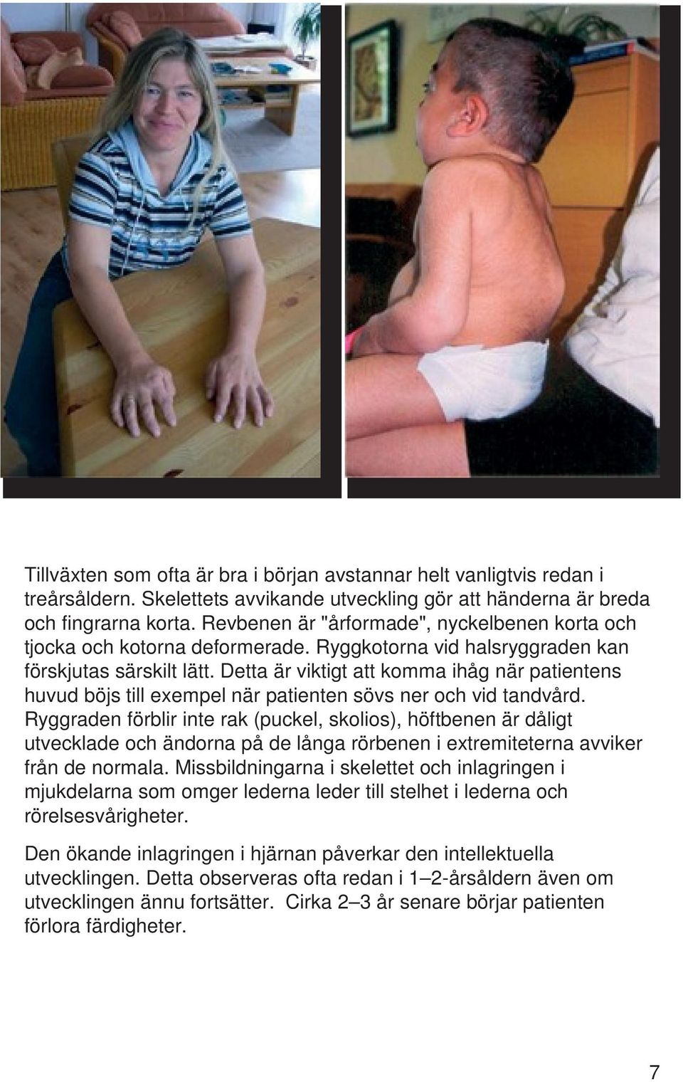 Detta är viktigt att komma ihåg när patientens huvud böjs till exempel när patienten sövs ner och vid tandvård.