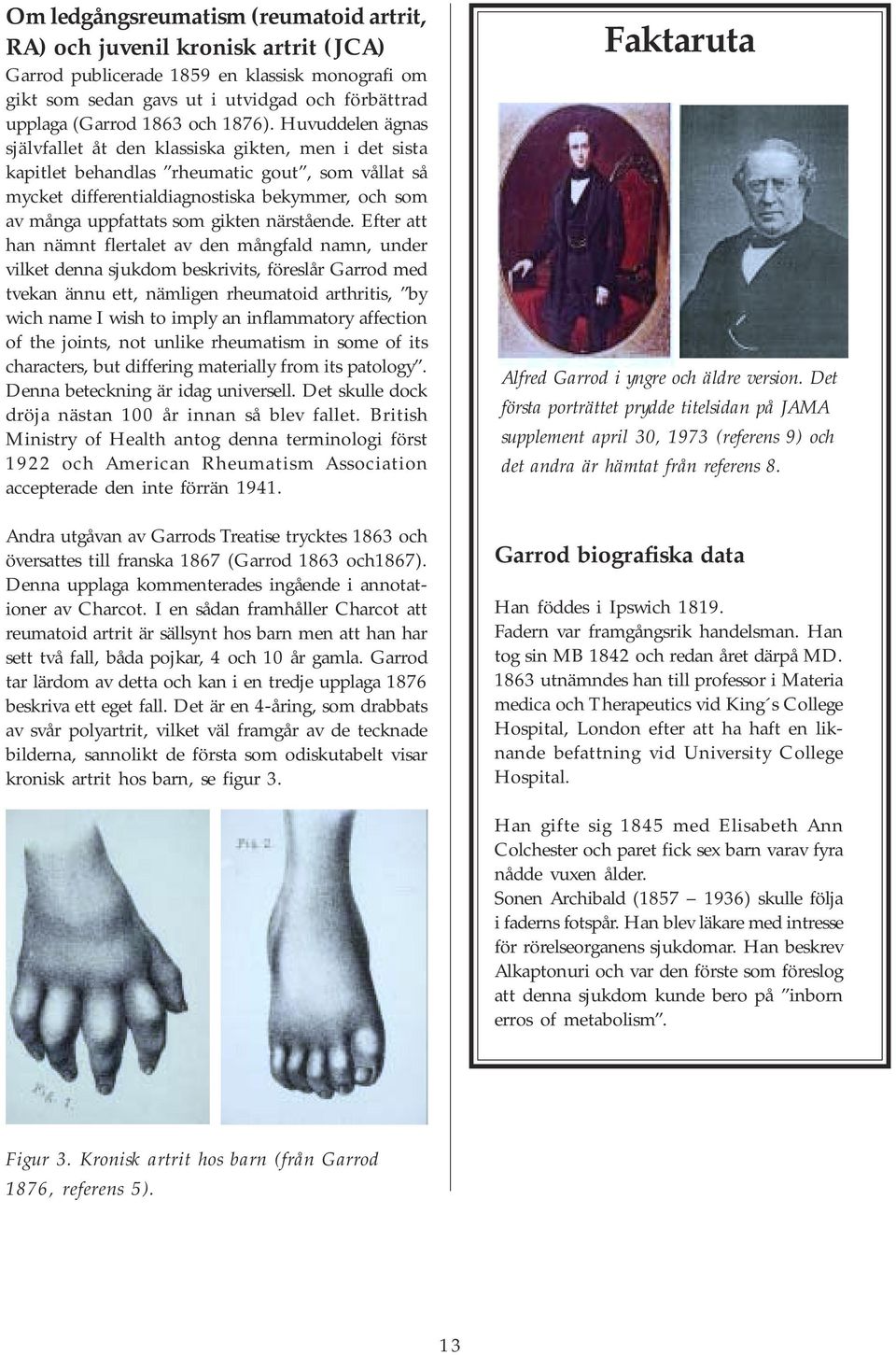 Huvuddelen ägnas självfallet åt den klassiska gikten, men i det sista kapitlet behandlas rheumatic gout, som vållat så mycket differentialdiagnostiska bekymmer, och som av många uppfattats som gikten