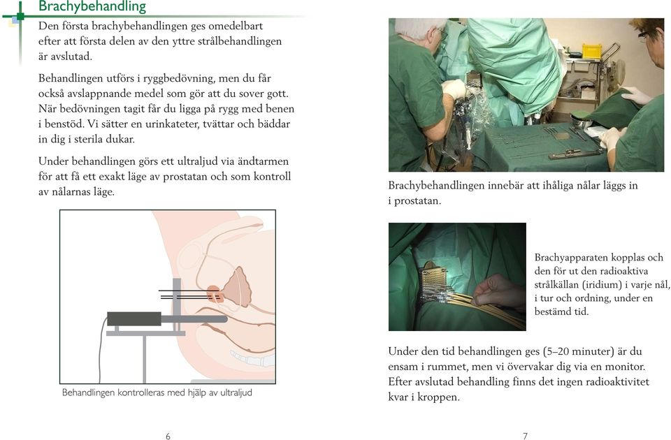 Vi sätter en urinkateter, tvättar och bäddar in dig i steria dukar. Under behandingen görs ett utrajud via ändtarmen för att få ett exakt äge av prostatan och som kontro av nåarnas äge.