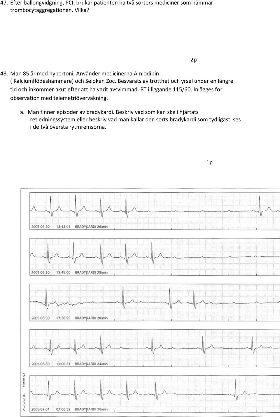 Besvärats av trötthet och yrsel under en längre tid och inkommer akut efter att ha varit avsvimmad. BT i liggande 115/60.