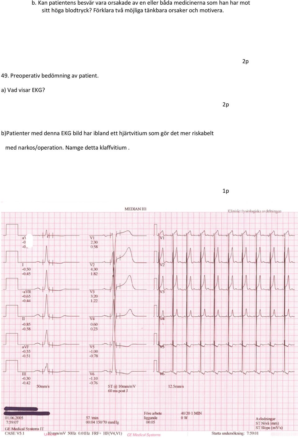 Preoperativ bedömning av patient. a) Vad visar EKG?