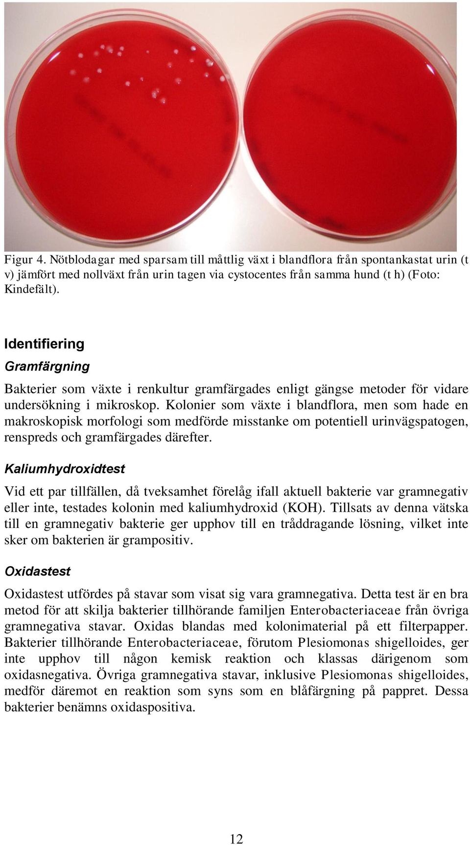Kolonier som växte i blandflora, men som hade en makroskopisk morfologi som medförde misstanke om potentiell urinvägspatogen, renspreds och gramfärgades därefter.