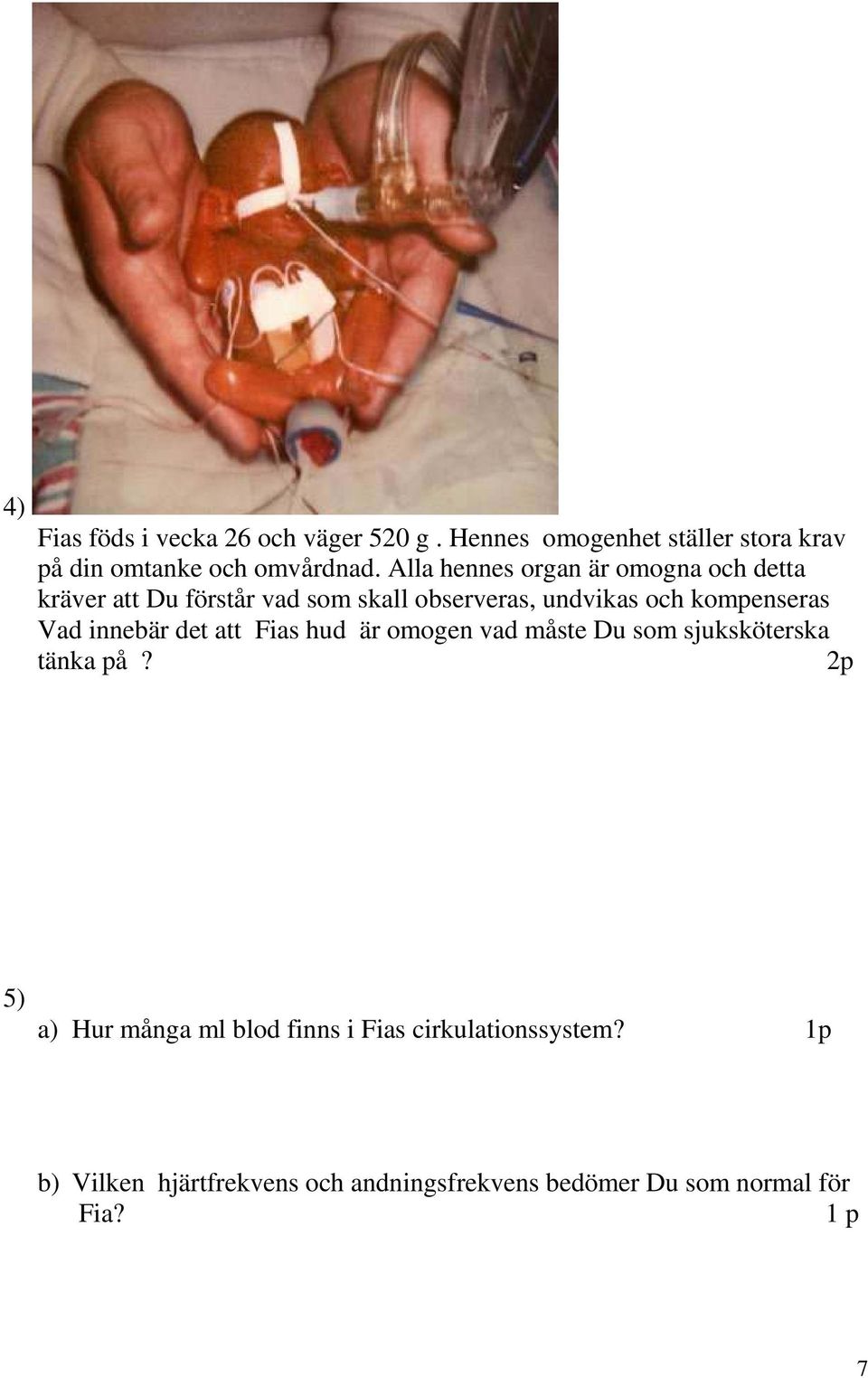 Vad innebär det att Fias hud är omogen vad måste Du som sjuksköterska tänka på?