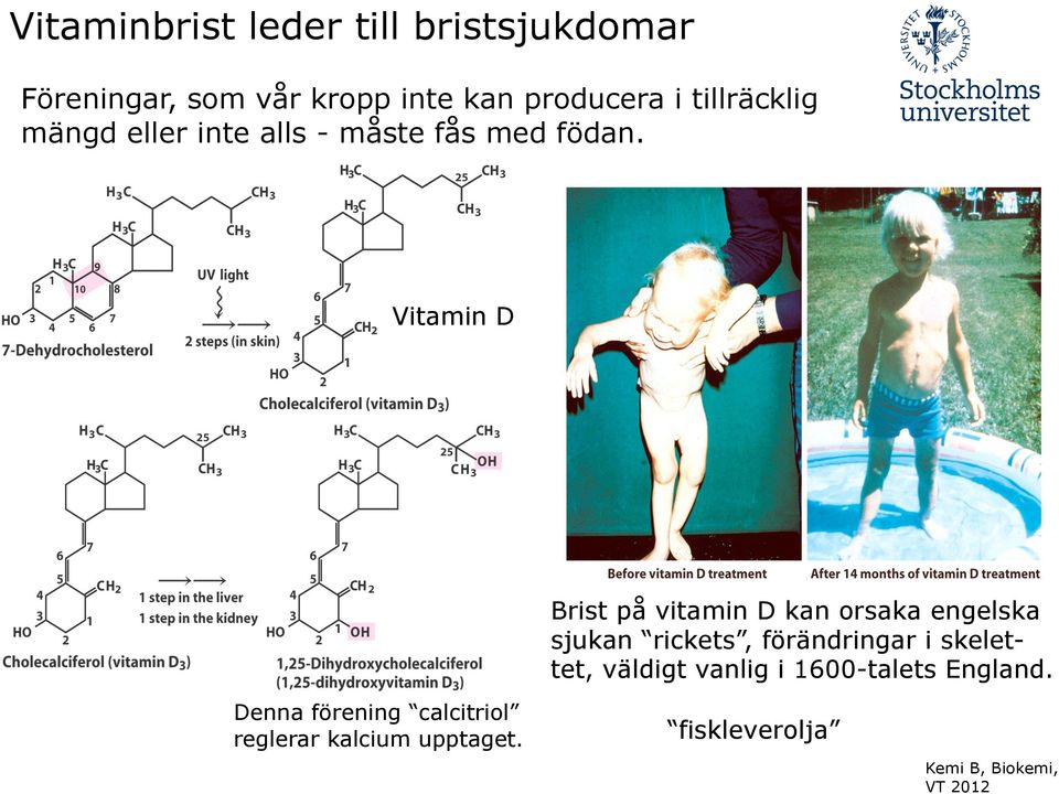 Vitamin D Brist på vitamin D kan orsaka engelska sjukan rickets, förändringar i