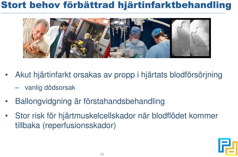 Ballongvidgning är förstahandsbehandling Stor risk för