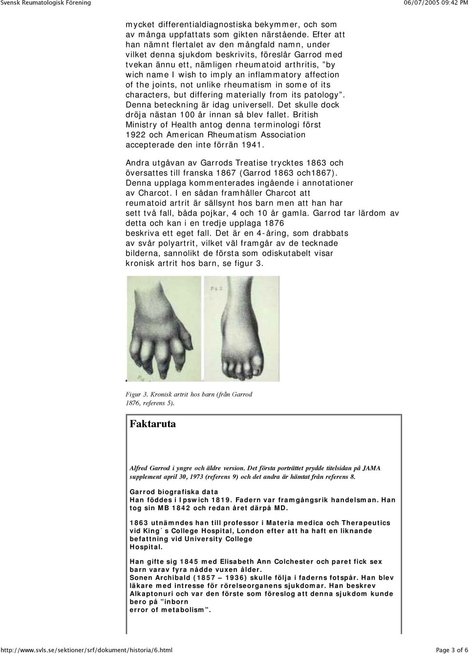inflammatory affection of the joints, not unlike rheumatism in some of its characters, but differing materially from its patology. Denna beteckning är idag universell.