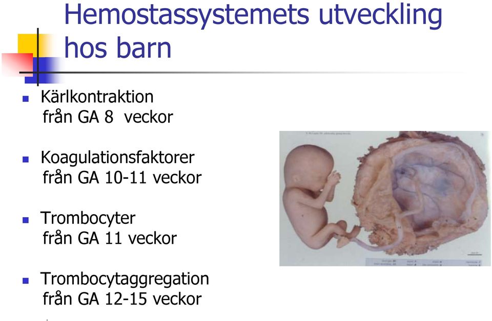 Koagulationsfaktorer från GA 10-11 veckor