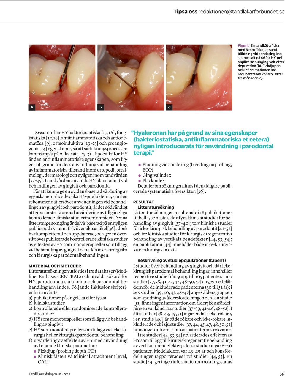 a b c Dessutom har HY bakteriostatiska [5, 6], fungistatiska [, 8], antiinflammatoriska och antiödematösa [9], osteoinduktiva [9 23] och proangiogena [24] egenskaper, så att sårläkningsprocessen kan
