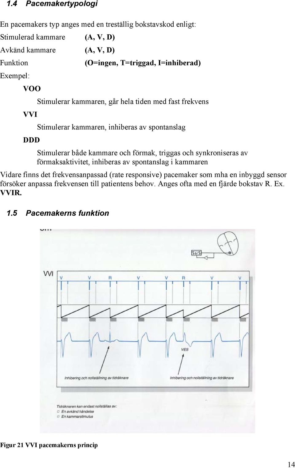 kammare och förmak, triggas och synkroniseras av förmaksaktivitet, inhiberas av spontanslag i kammaren Vidare finns det frekvensanpassad (rate responsive) pacemaker