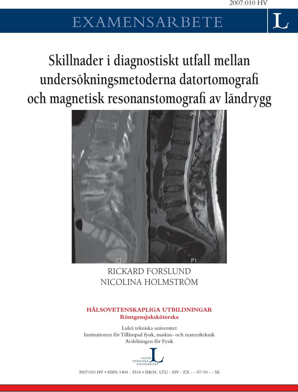 HÄLSOVETENSKAPLIGA UTBILDNINGAR Röntgensjuksköterska Luleå tekniska universitet Institutionen för