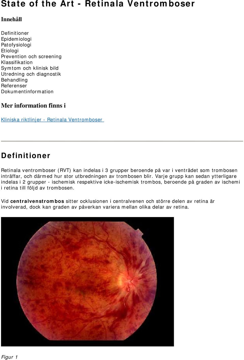 trombosen inträffar, och därmed hur stor utbredningen av trombosen blir.