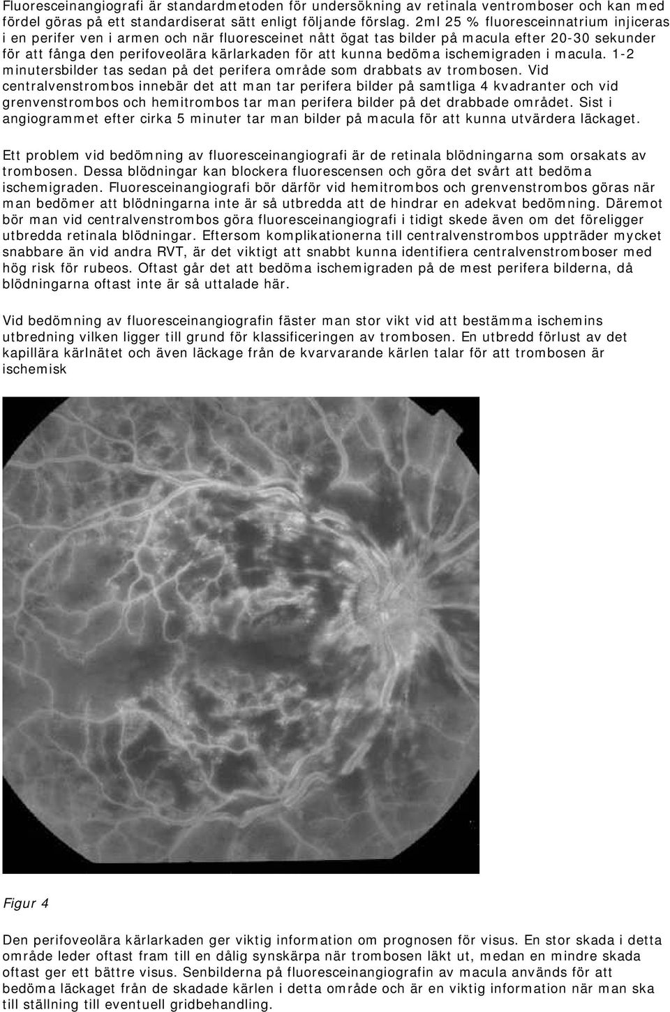 bedöma ischemigraden i macula. 1-2 minutersbilder tas sedan på det perifera område som drabbats av trombosen.
